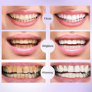 BrightSmile [V34]® - Clareamento Dental